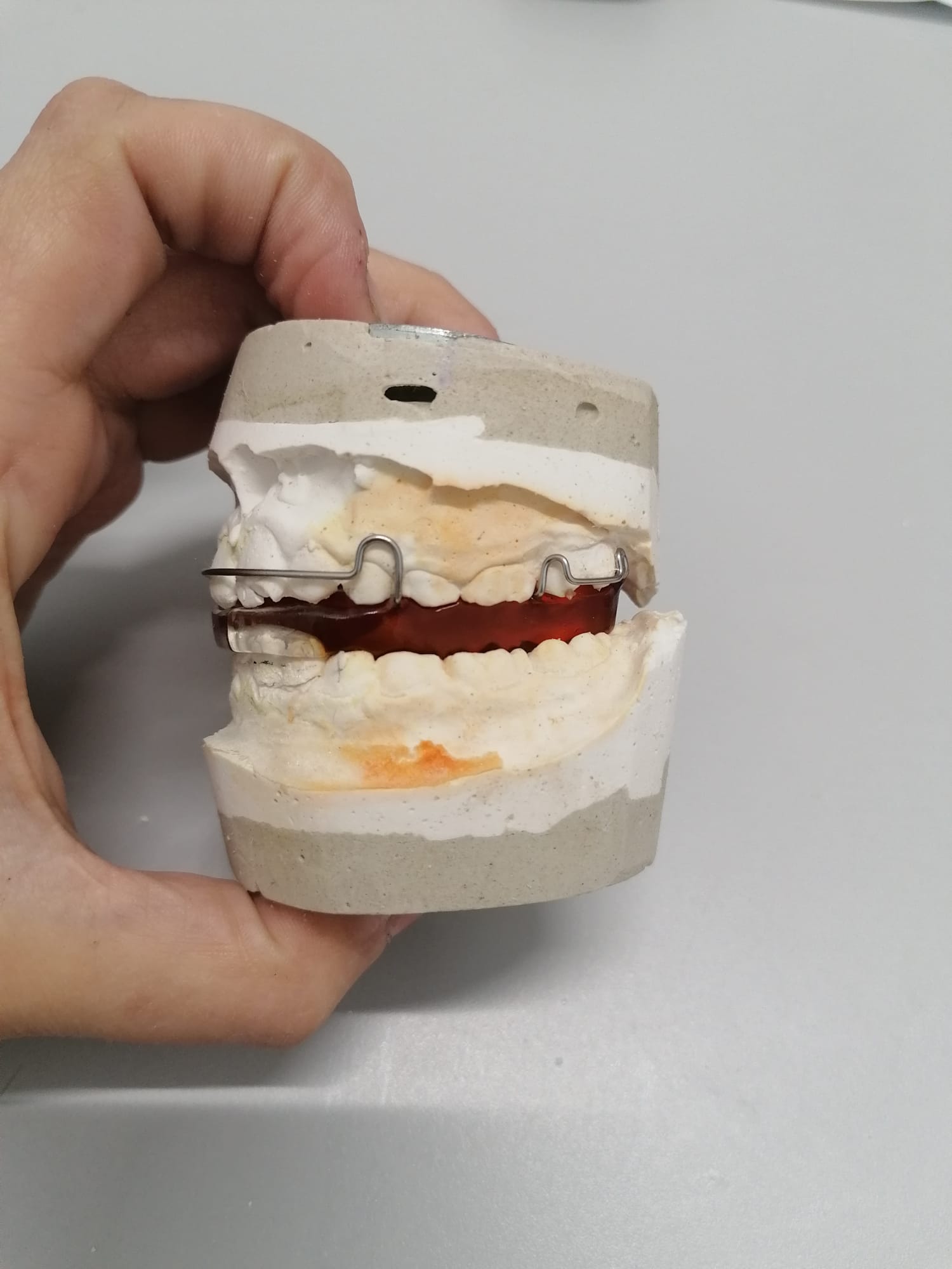 Ortodoncia: bionator con tornillo de expansión
